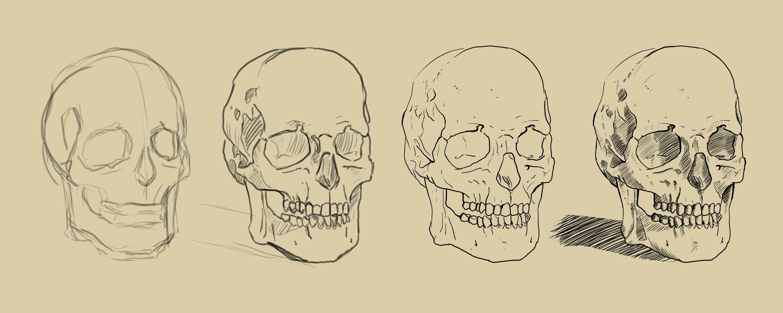 étape crane psk.jpg